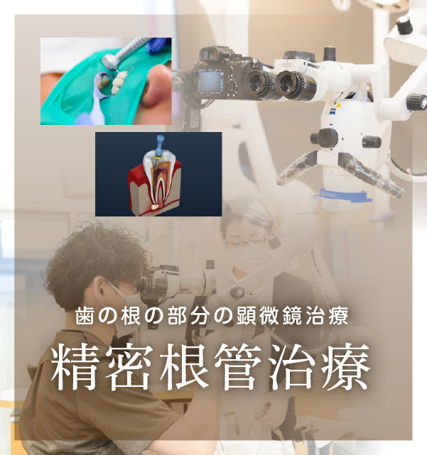 マイクロスコープ・根管治療