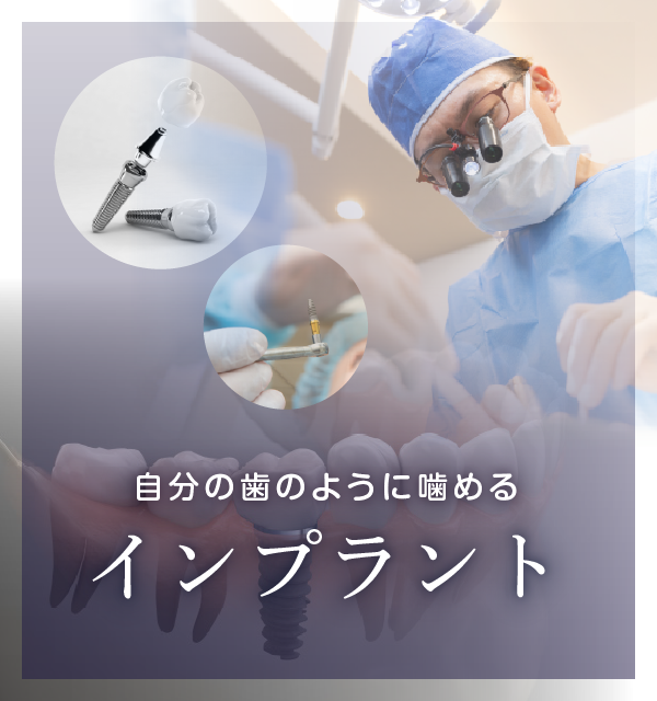 第二の永久歯・インプラント治療・ストローマン