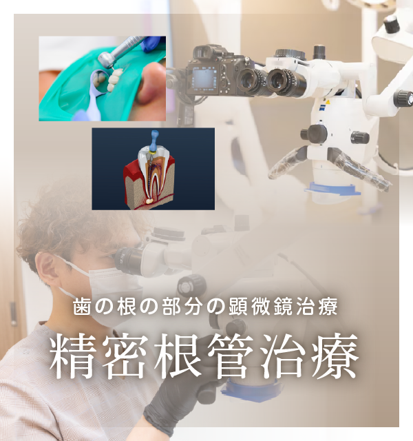 マイクロスコープ・根管治療