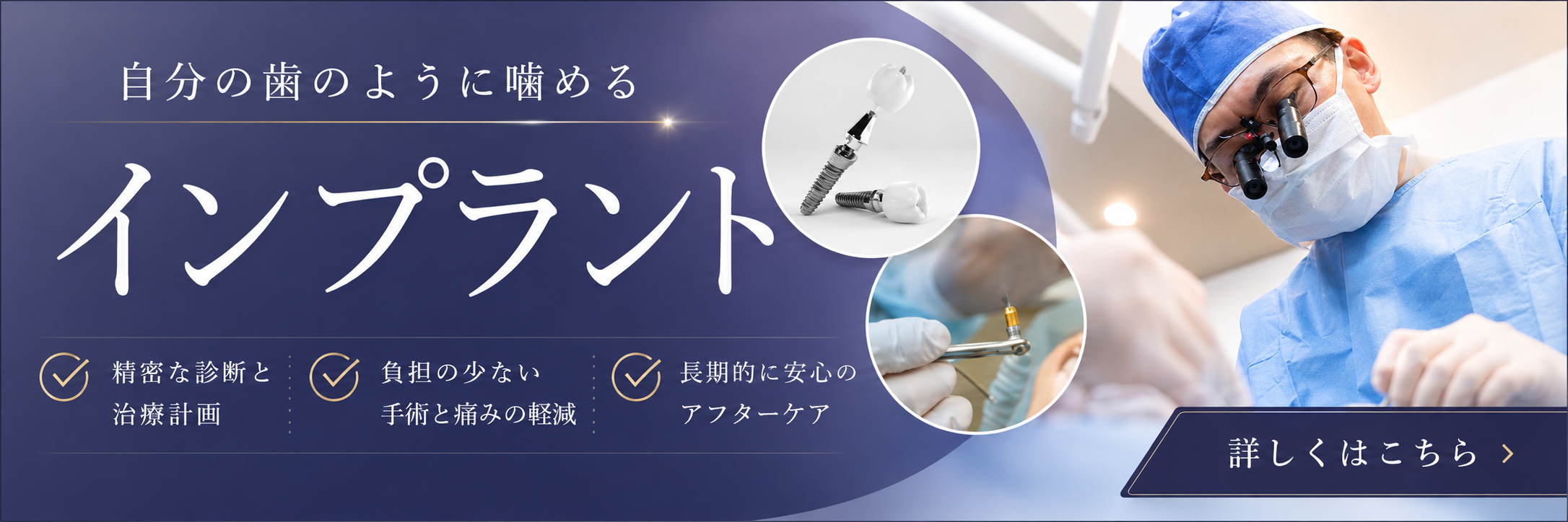インプラント治療